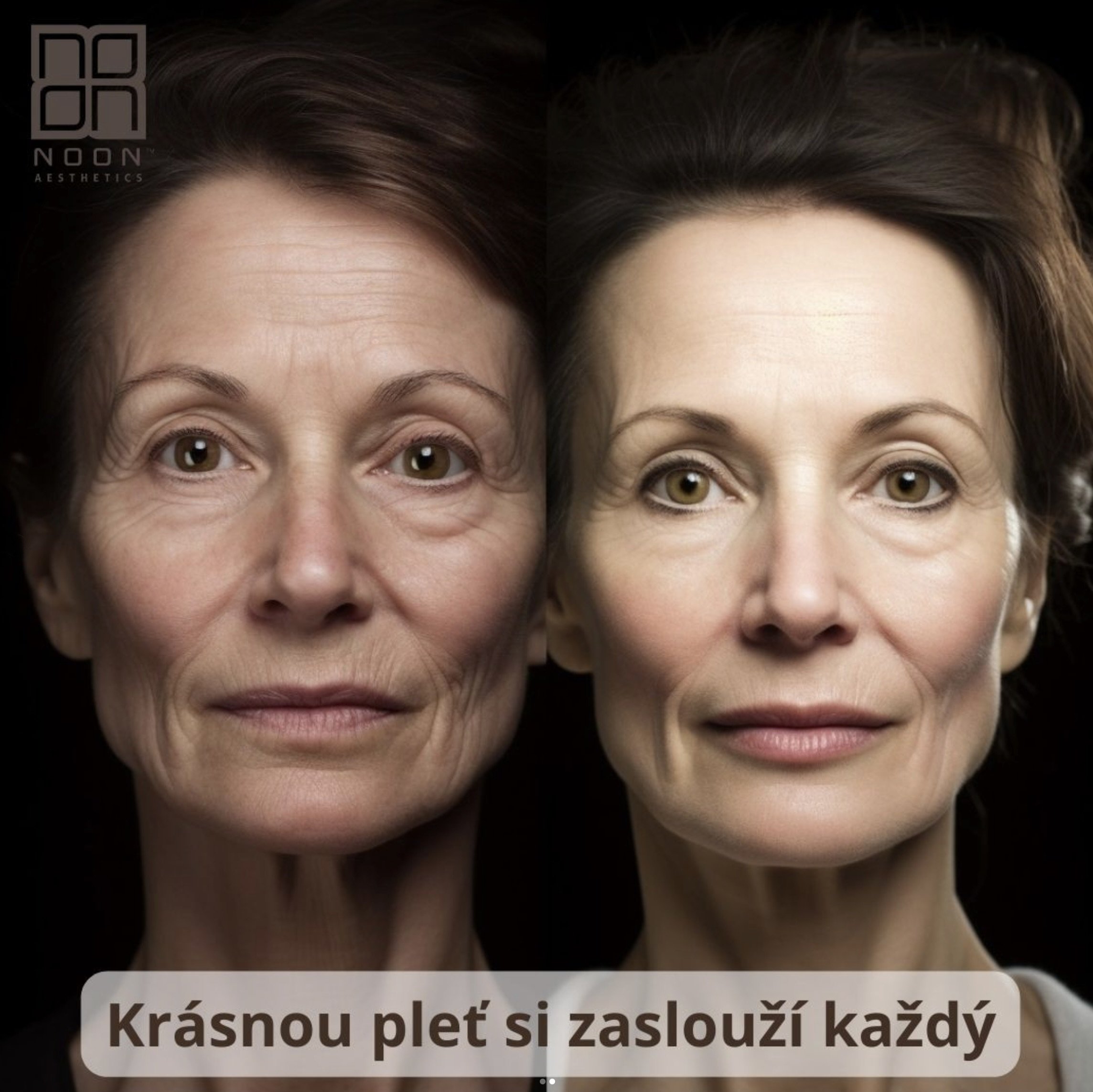 Fotografie před zákrokem Triple MCH a fotografie po podstoupení zákroku Fotografie před zákrokem Triple MCH a fotografie po podstoupení zákroku
