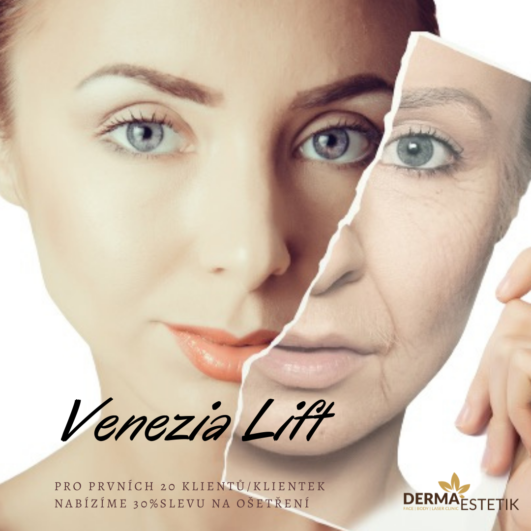 Před a po zákroku laserem CO2 Venezia Lift Před a po zákroku laserem CO2 Venezia Lift