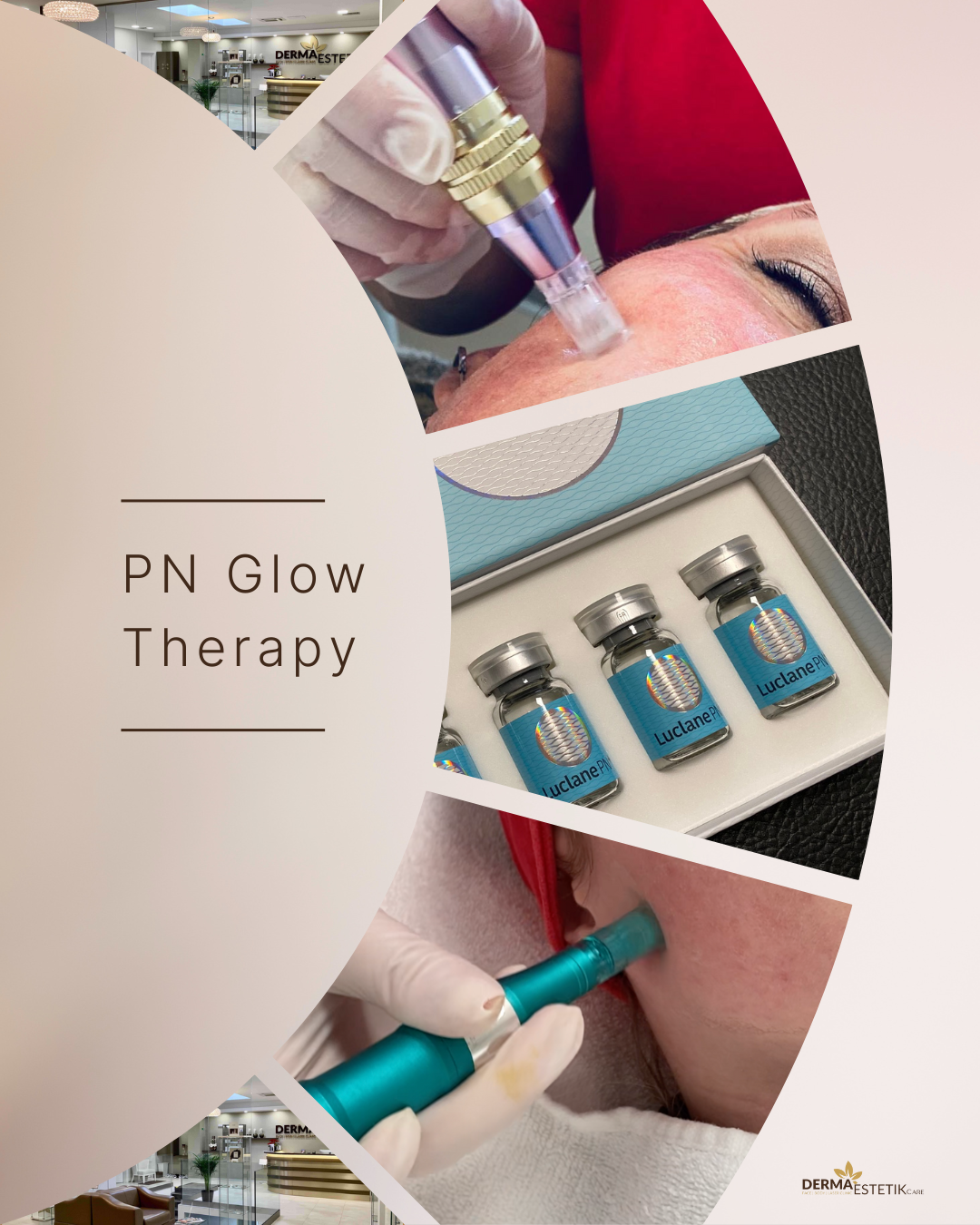 Black-Aesthetic-Photo-Collage-Instagram-Post-6