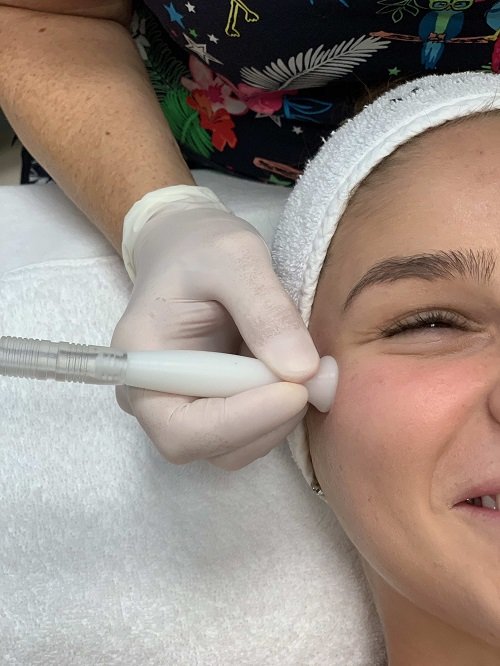 První krok čištění pomocí HydroFacial Clean První krok čištění pomocí HydroFacial Clean