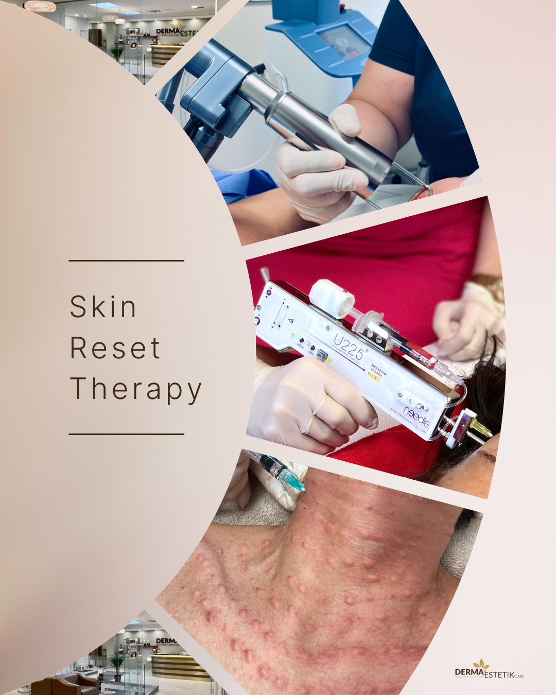 SKIN-RESET-THERAPY-3